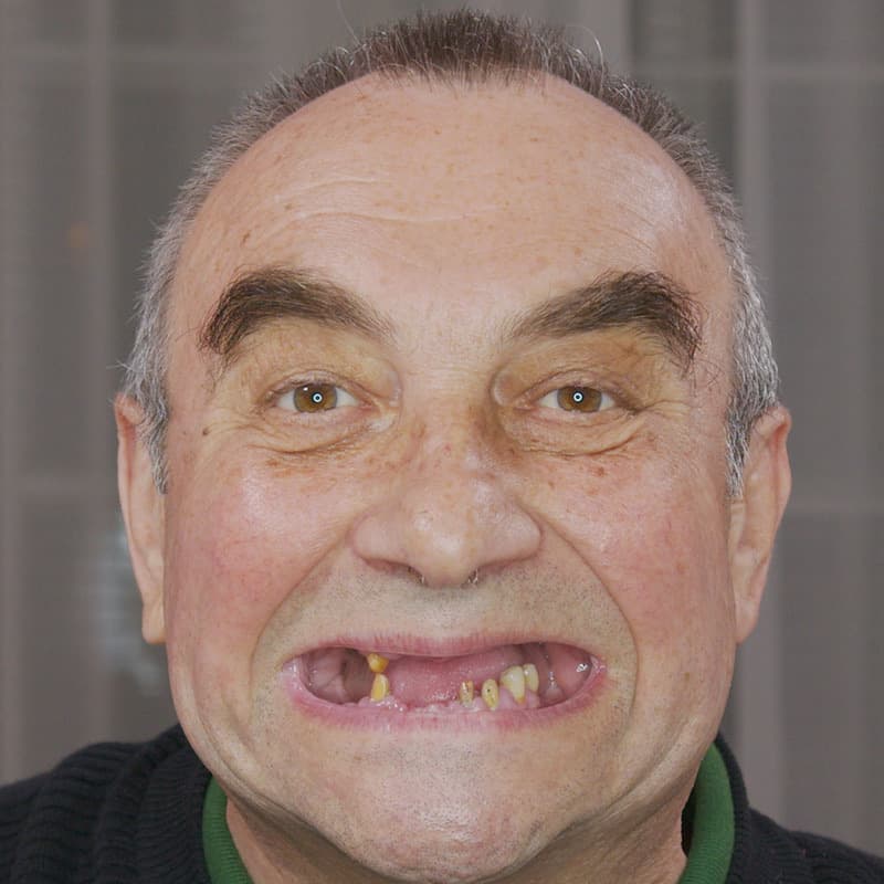 Before treatment